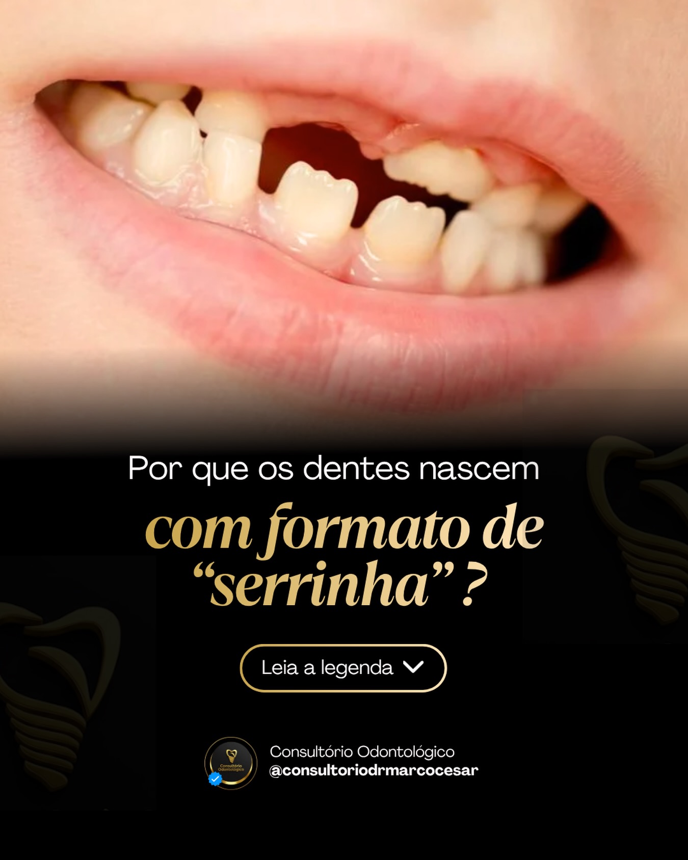 Postagem do Instagram sobre formatos dos dentes